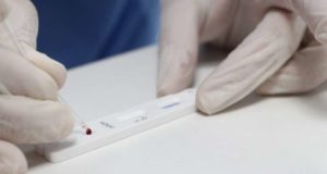 Prefeitura inicia testagem de profissionais da Saúde